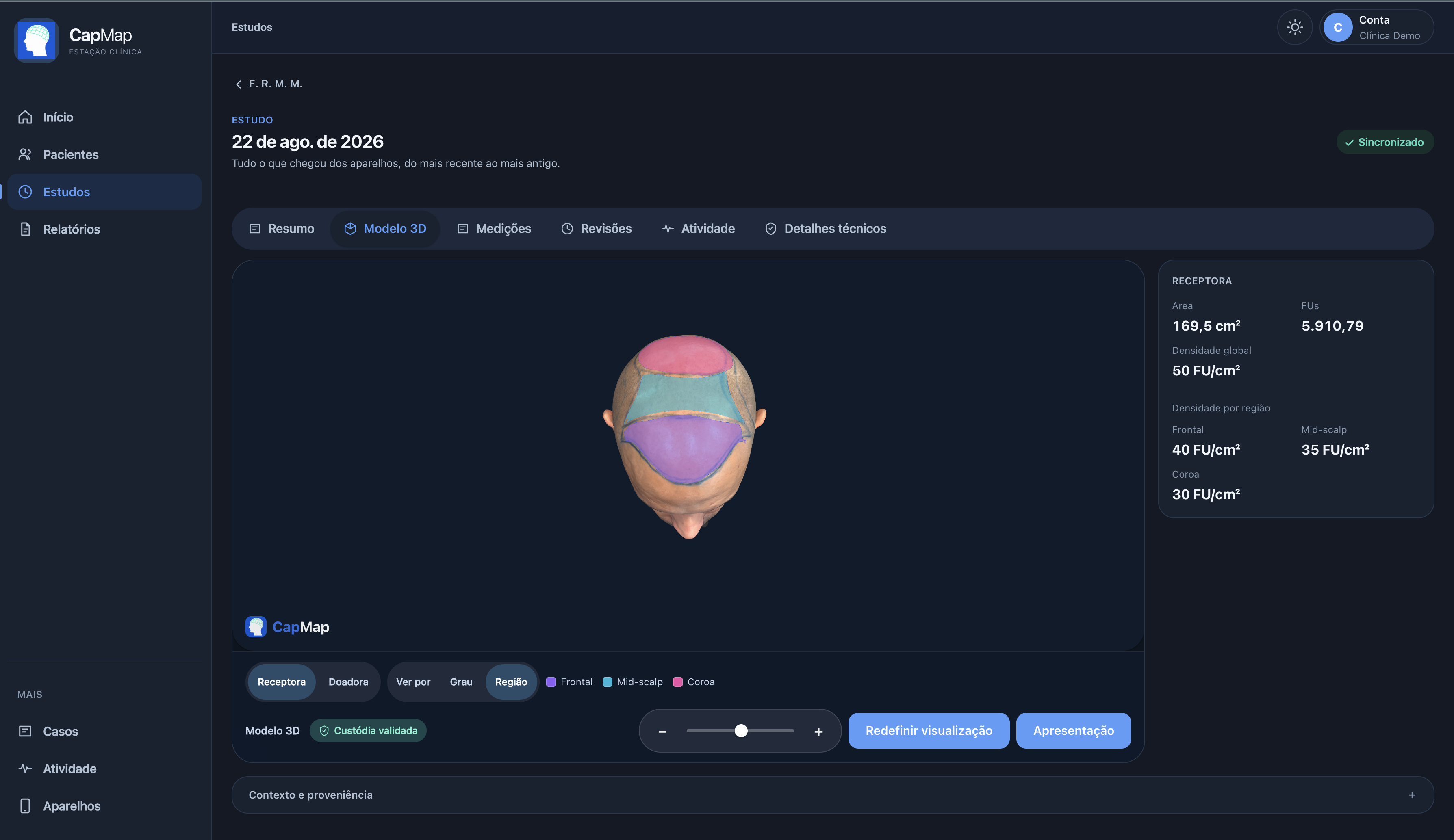 Portal CapMap com modelo 3D, regiões clínicas coloridas e painel de medições.